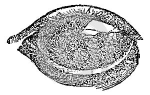 Eye with Vesicular or Pustular Keratitis, vintage engraving