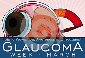 Eyeball with Manometer to Commemorate Glaucoma Week, Vector Illustration