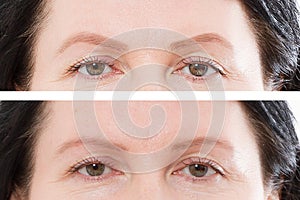 Before after eyebrow threading and eyebrows shaping cosmetic procedure. Closeup middle age woman face. Before-after skin and