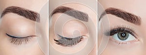 Eyelash extension procedure close up.