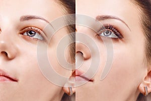 Eyelash Extension Procedure. Comparison of female eyes before and after.