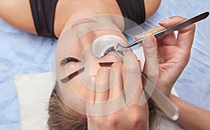 Eyelash removal procedure close up.