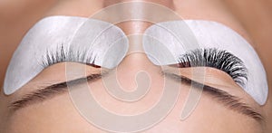 Eyelash removal procedure close up.