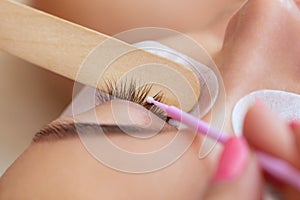 Eyelash removal procedure close up