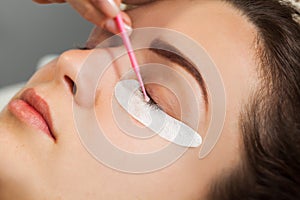 Eyelash removal procedure close up. Eyelash extension