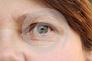 Eyes of an elderly woman with wrinkles on the eyelids, part of the face close-up, overhang, the concept of age-related changes in