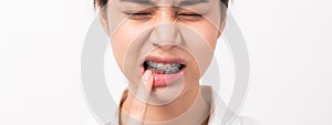 Face of asian woman finger touches a toothache maybe because of poor care.