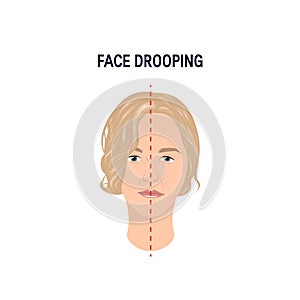 Face drooping concept