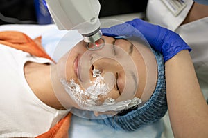 Face Having A Laser Skin Treatment, A Resurfacing Technique For Wrinkles