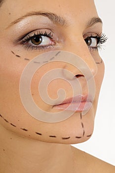 Face lift/ plastic surgery