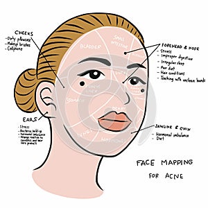 Face mapping for acne , beautiful woman face illustration