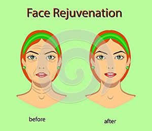 Face rejuvenation, vector illustration with before after effect