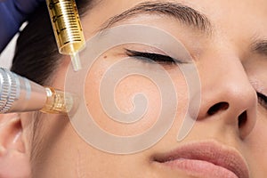 Face shot of woman at micro needle cosmetic treatment session