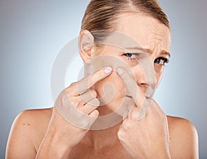 Face, skincare and woman squeeze acne, pimple or blackhead in studio on a gray background. Wellness, dermatology and