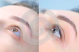 Face of young woman before and after lash laminating and painting eyebrows, side view.