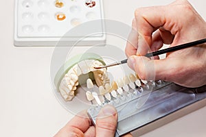 Facial Dental Prosthetic