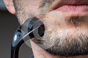 Facial hair care concept. Young man is using derma roller  on beard.