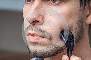 Facial hair care concept. Young man is using derma roller  on beard. photo