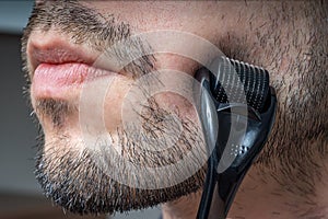 Facial hair care concept. Young man is using derma roller  on beard. photo