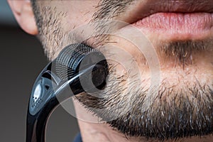 Facial hair care concept. Young man is using derma roller  on beard. photo