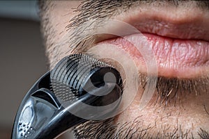 Facial hair care concept. Young man is using derma roller  on beard. photo