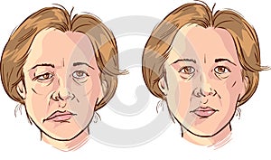 Facial lopsided illustration