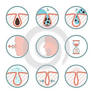 Facial treatments icons. Treatment of skin diseases, sebum removal and pores cleaning vector illustration photo