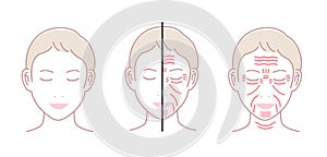 Facial wrinkles  female face  vector illustration set / no text