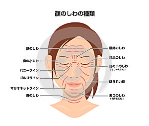 Facial wrinkles ( female face ) vector illustration / Japanese
