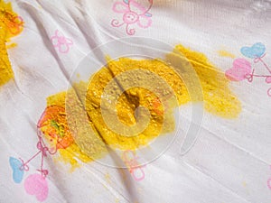 Faeces of a newborn baby on the diaper. Liquid yellow color and granular photo