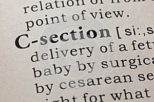 Definition of C-section