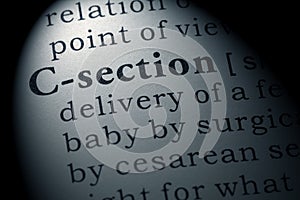 Definition of C-section