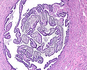 Fallopian tube. Mucosa folds