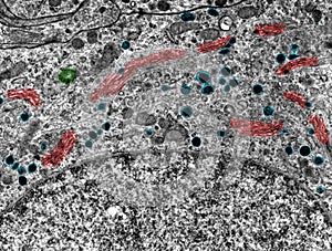 Golgi complex. TEM photo