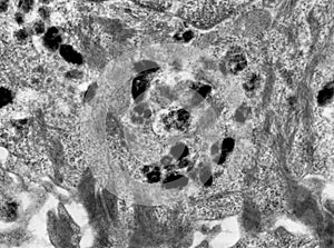 Melanin granules in skin cell, TEM photo