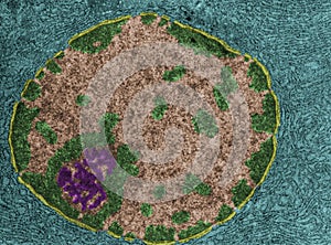 Nucleus and nucleolus. False colour TEM photo