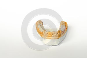 False teeth. bridge-ceramic-metal prostheses. Ceramic teeth dentures