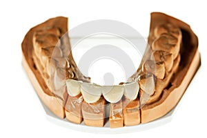 False teeth prosthesis