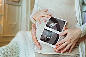Family planning. Loving husband hugging his pregnant wife holding ultrasound scan in hands
