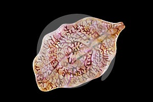 Fasciola hepatica, or liver fluke