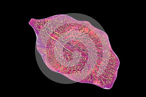 Fasciola hepatica, or liver fluke photo