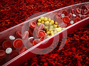 Fat cells blocking the blood flow inside human vein. 3D illustration