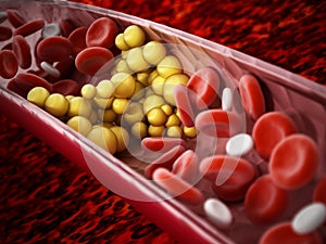 Fat cells blocking the blood flow inside human vein. 3D illustration