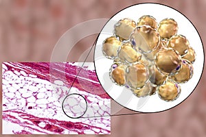 Fat cells, micrograph and 3D illustration