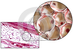 Fat cells, micrograph and 3D illustration