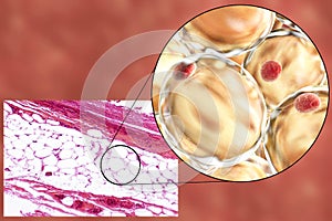 Fat cells, micrograph and 3D illustration