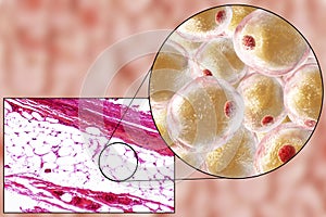 Fat cells, micrograph and 3D illustration photo