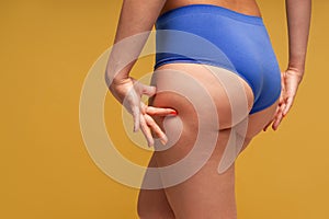 Fat female hips and buttocks, cellulite on the human body on yellow background