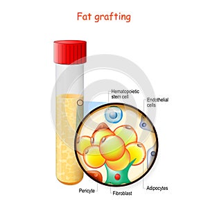 Fat grafting structure. Test tube with fat