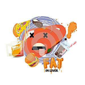 Fat in liver concept - vector